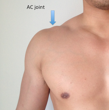 AC Joint - FIT AS A PHYSIO | MOSMAN